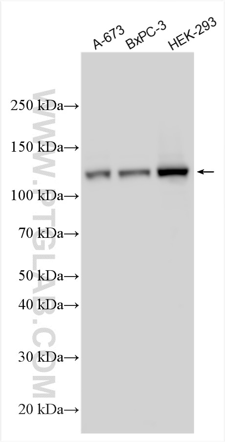 Western Blot (WB) analysis of various lysates using USP25 Polyclonal antibody (12199-1-AP)
