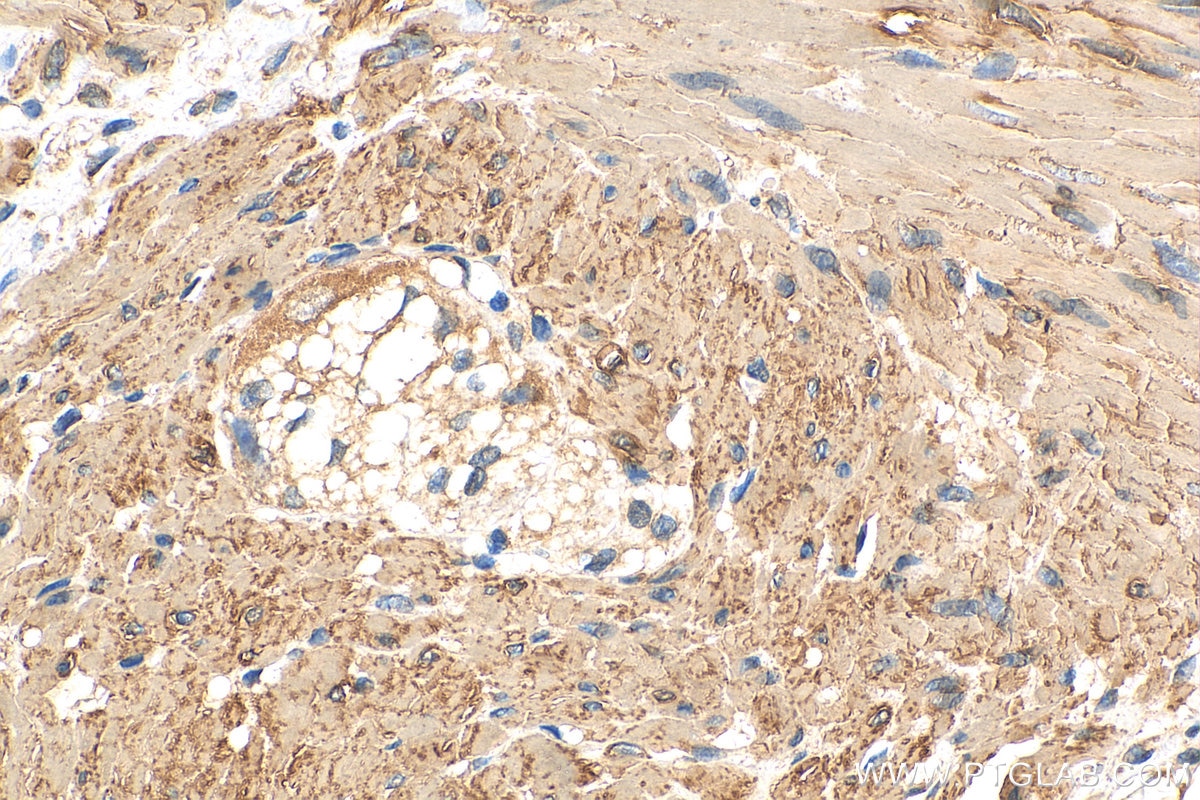 Immunohistochemistry (IHC) staining of human colon tissue using USP25 Polyclonal antibody (28817-1-AP)