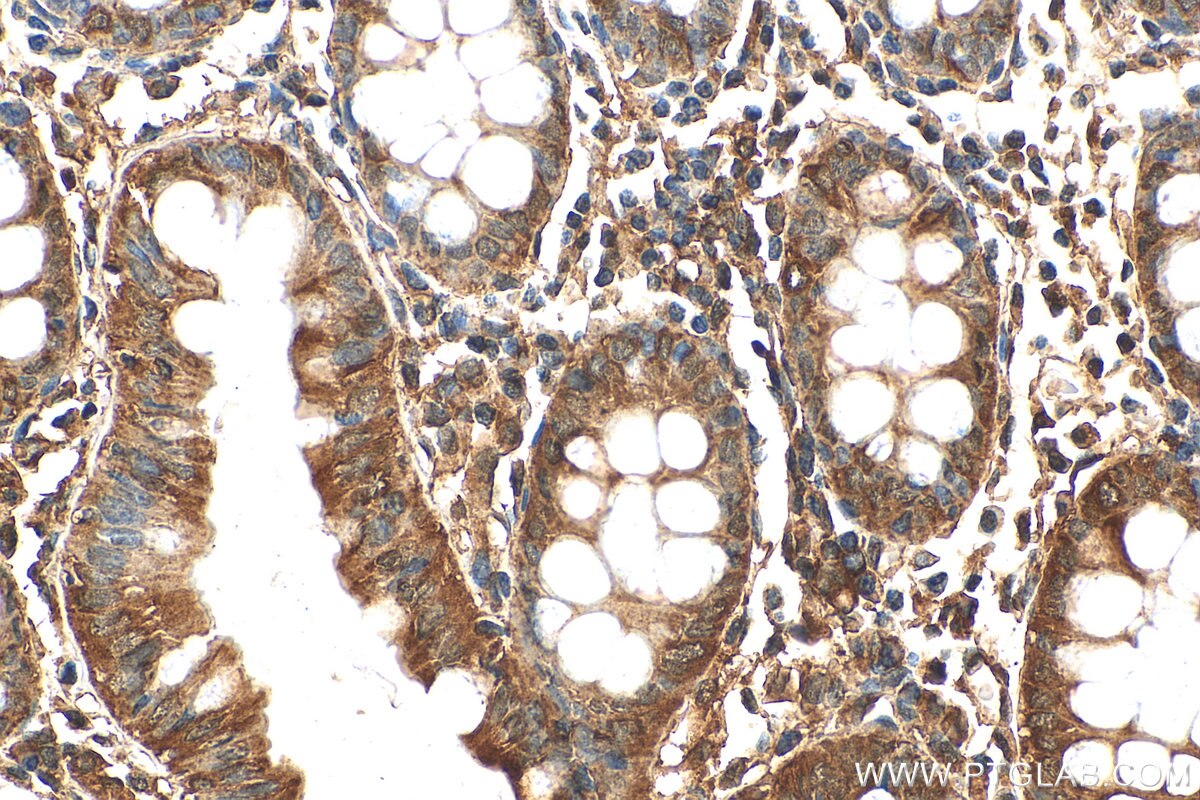 Immunohistochemistry (IHC) staining of human colon tissue using USP25 Polyclonal antibody (28817-1-AP)