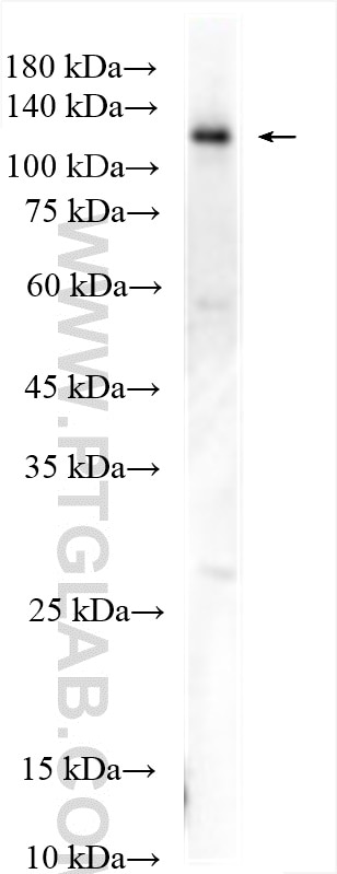 Western Blot (WB) analysis of PC-3 cells using USP25 Polyclonal antibody (28817-1-AP)