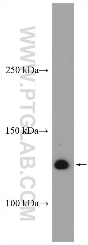 Western Blot (WB) analysis of RAW 264.7 cells using USP25 Polyclonal antibody (28817-1-AP)