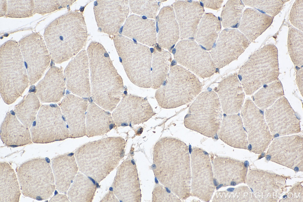 Immunohistochemistry (IHC) staining of mouse skeletal muscle tissue using USP25 Monoclonal antibody (67769-1-Ig)