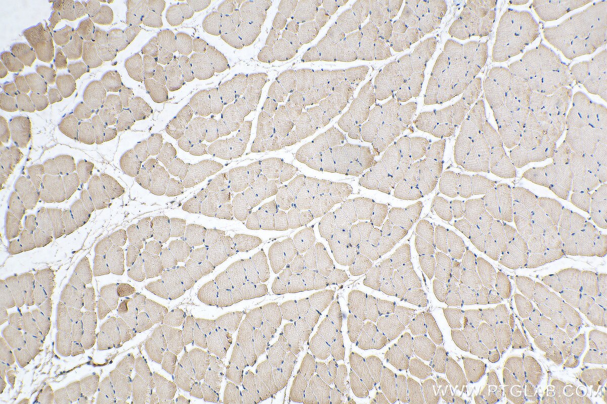 Immunohistochemistry (IHC) staining of mouse skeletal muscle tissue using USP25 Monoclonal antibody (67769-1-Ig)