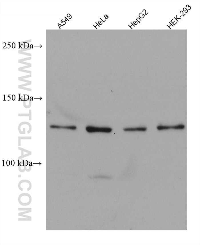 Western Blot (WB) analysis of various lysates using USP25 Monoclonal antibody (67769-1-Ig)