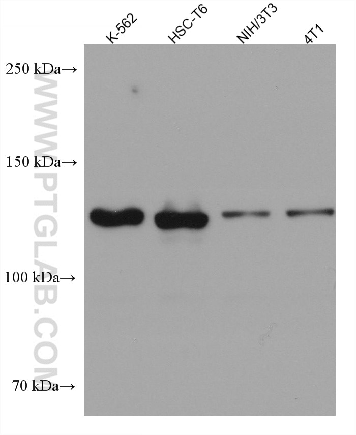 Western Blot (WB) analysis of various lysates using USP25 Monoclonal antibody (67769-1-Ig)