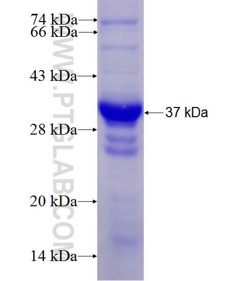 USP25 fusion protein Ag28067 SDS-PAGE