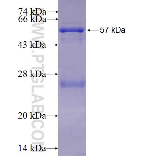 USP25 fusion protein Ag2837 SDS-PAGE