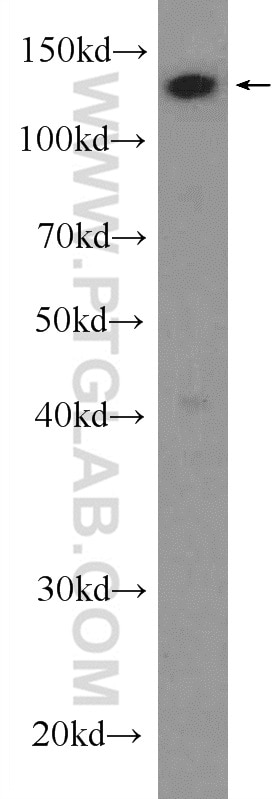 Western Blot (WB) analysis of mouse heart tissue using USP28 Polyclonal antibody (17707-1-AP)