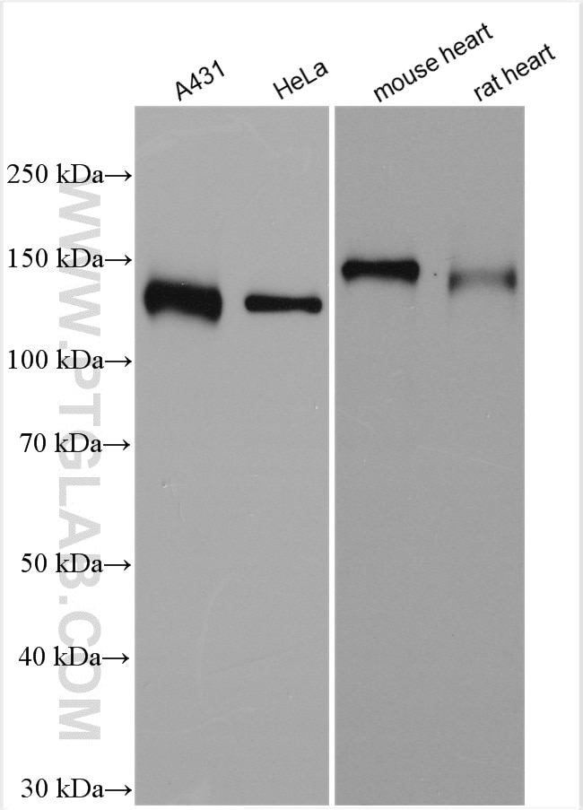 Western Blot (WB) analysis of various lysates using USP28 Polyclonal antibody (17707-1-AP)