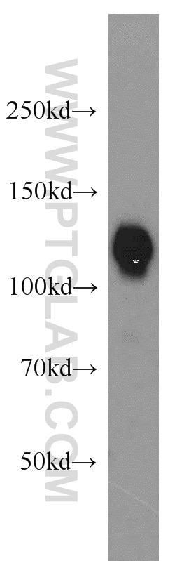 Western Blot (WB) analysis of HeLa cells using USP28 Polyclonal antibody (17707-1-AP)