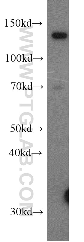 Western Blot (WB) analysis of HeLa cells using USP28 Polyclonal antibody (17707-1-AP)