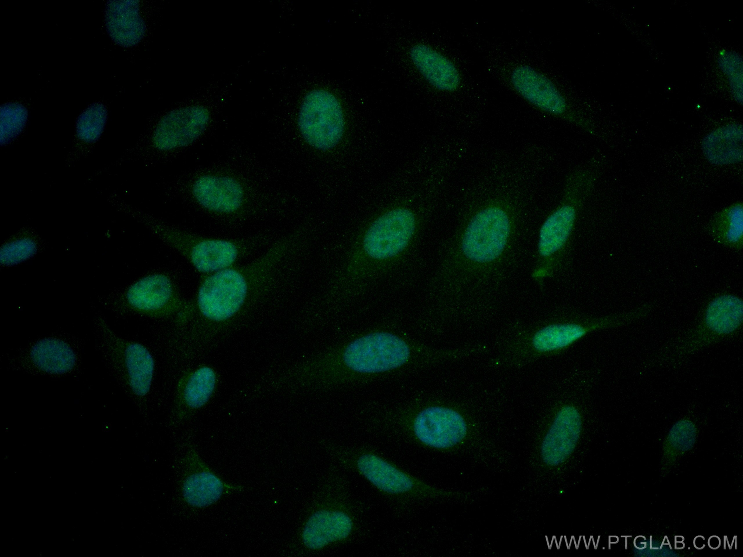 Immunofluorescence (IF) / fluorescent staining of HeLa cells using USP28 Monoclonal antibody (67814-1-Ig)