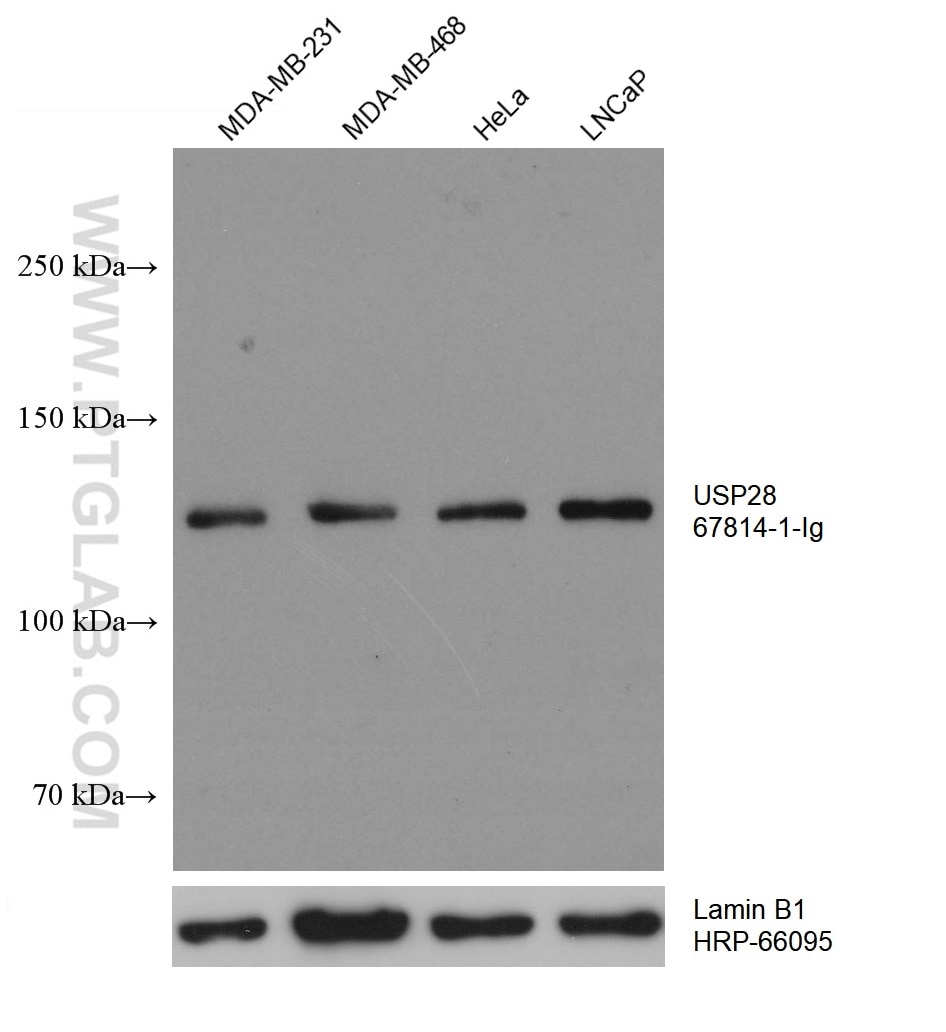 Western Blot (WB) analysis of various lysates using USP28 Monoclonal antibody (67814-1-Ig)