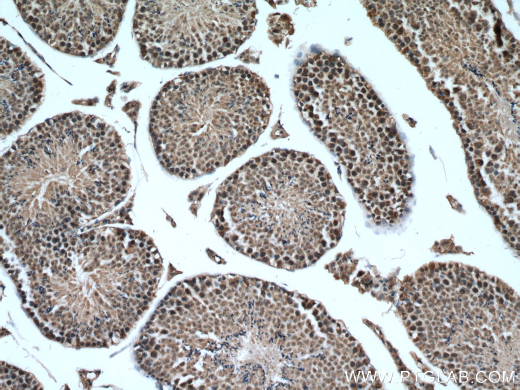 IHC staining of mouse testis using 27522-1-AP