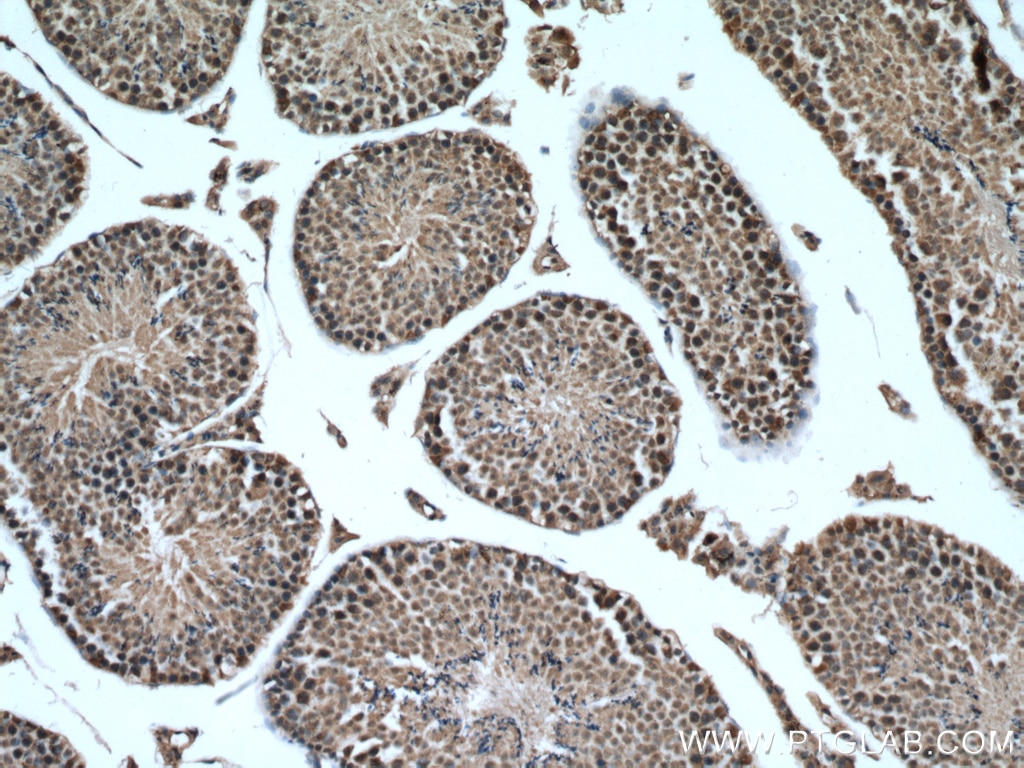 Immunohistochemistry (IHC) staining of mouse testis tissue using USP29 Polyclonal antibody (27522-1-AP)