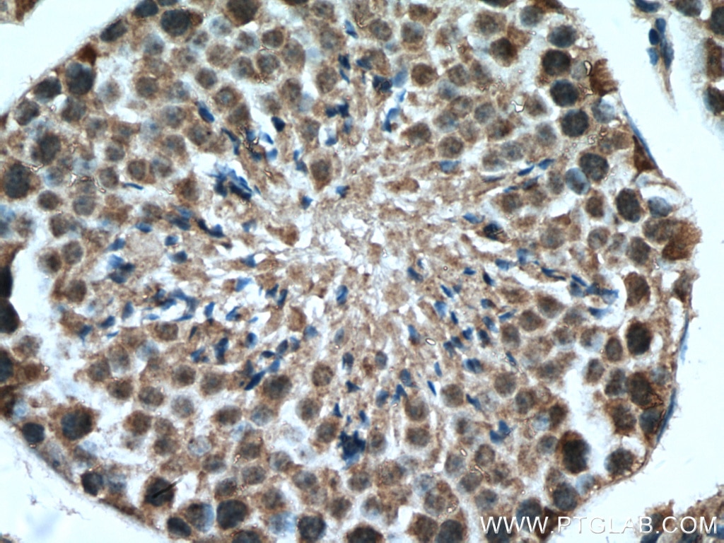 Immunohistochemistry (IHC) staining of mouse testis tissue using USP29 Polyclonal antibody (27522-1-AP)