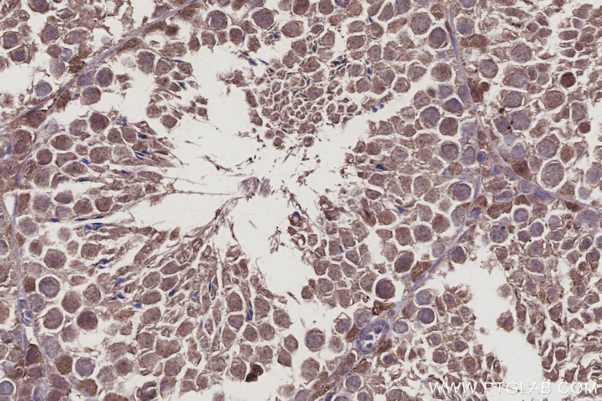 IHC staining of mouse testis using 27522-1-AP Immunohistochemistry (IHC) staining of mouse testis tissue using USP29 Polyclonal antibody (27522-1-AP)