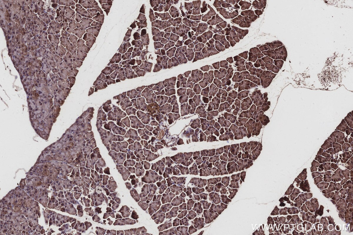 IHC staining of mouse pancreas using 27522-1-AP Immunohistochemistry (IHC) staining of mouse pancreas tissue using USP29 Polyclonal antibody (27522-1-AP)