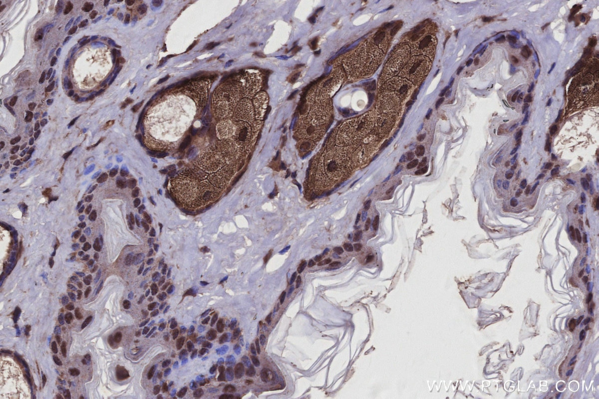IHC staining of mouse skin using 27522-1-AP Immunohistochemistry (IHC) staining of mouse skin tissue using USP29 Polyclonal antibody (27522-1-AP)