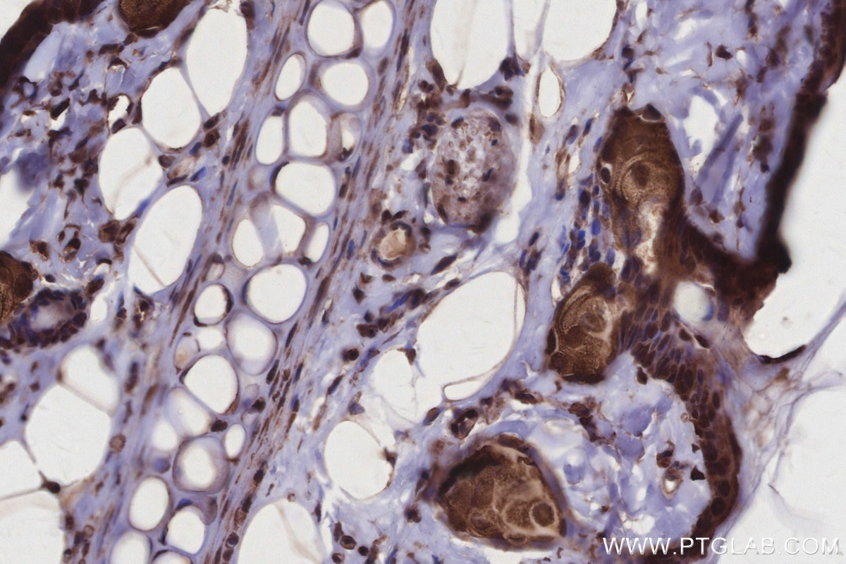 IHC staining of rat skin using 27522-1-AP Immunohistochemistry (IHC) staining of rat skin tissue using USP29 Polyclonal antibody (27522-1-AP)