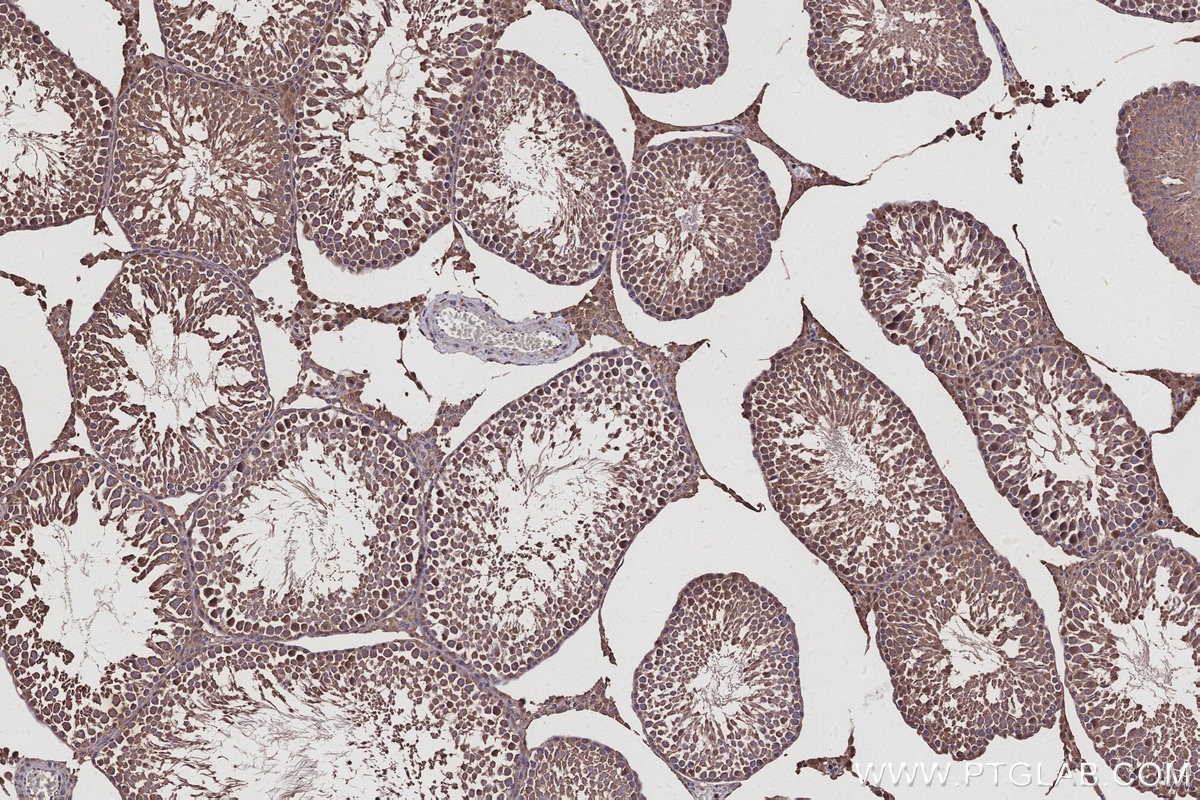 IHC staining of rat testis using 27522-1-AP Immunohistochemistry (IHC) staining of rat testis tissue using USP29 Polyclonal antibody (27522-1-AP)