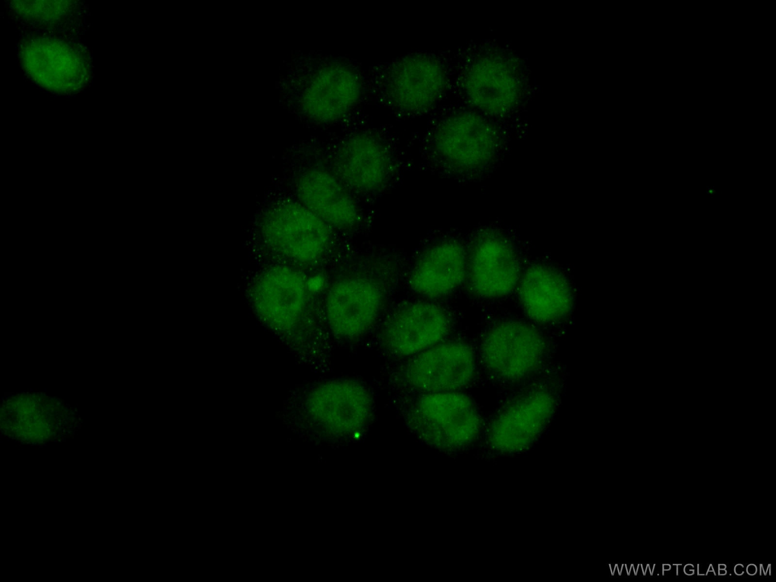 Immunofluorescence (IF) / fluorescent staining of HeLa cells using USP3 Polyclonal antibody (12490-1-AP)
