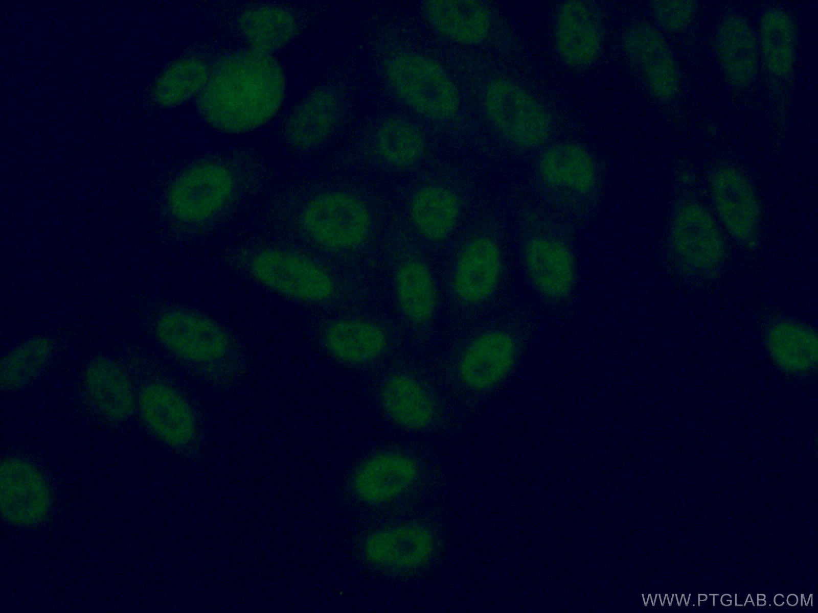 Immunofluorescence (IF) / fluorescent staining of HepG2 cells using USP3 Polyclonal antibody (12490-1-AP)