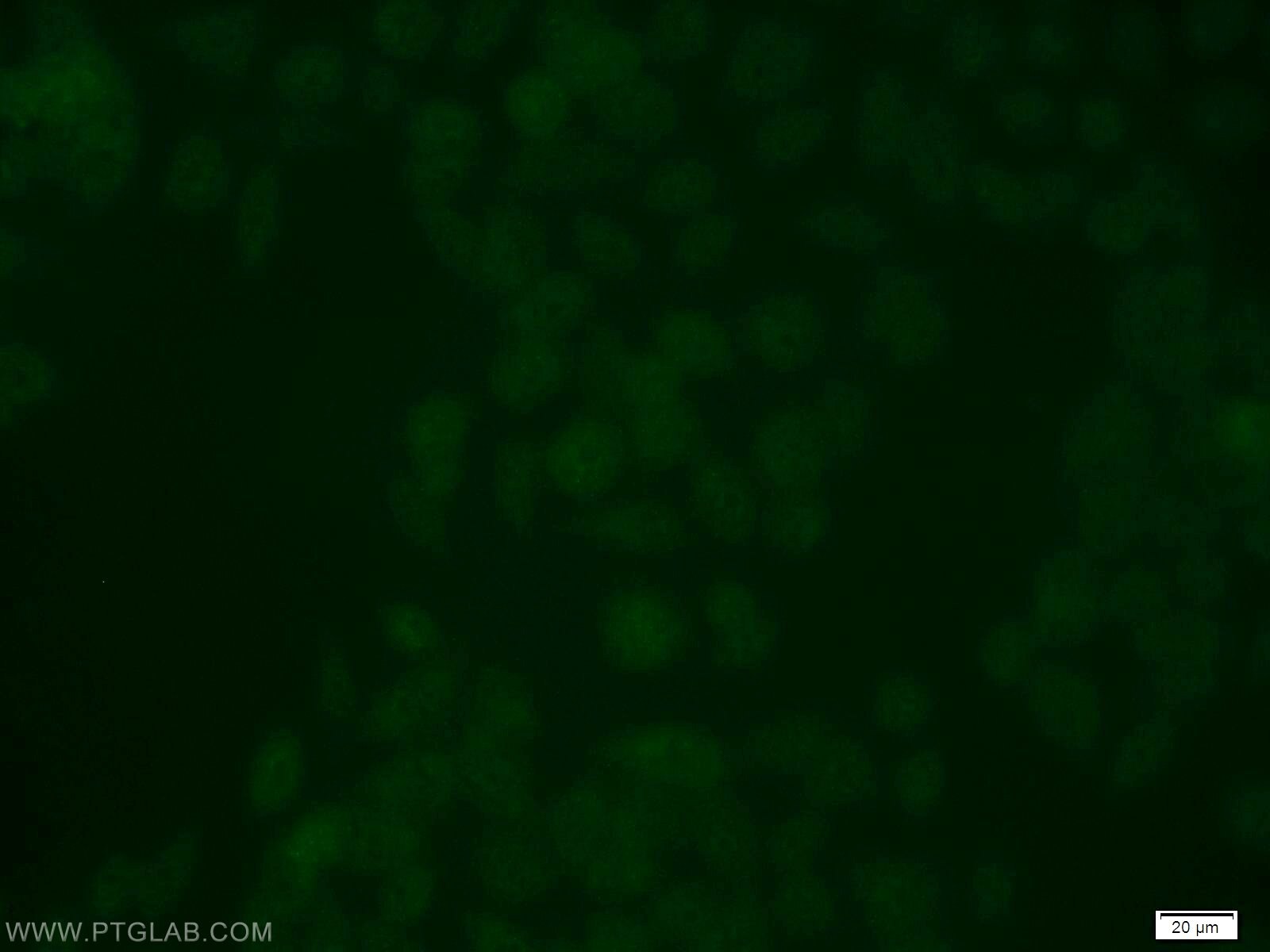 Immunofluorescence (IF) / fluorescent staining of MCF-7 cells using USP3 Polyclonal antibody (12490-1-AP)