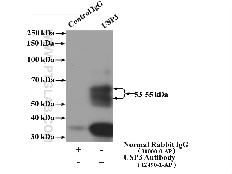 Immunoprecipitation (IP) experiment of mouse liver tissue using USP3 Polyclonal antibody (12490-1-AP)