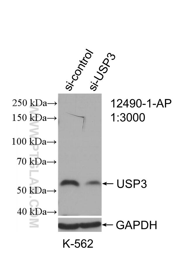 Western Blot (WB) analysis of K-562 cells using USP3 Polyclonal antibody (12490-1-AP)