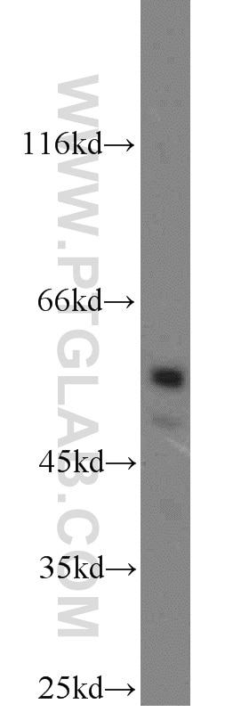 Western Blot (WB) analysis of RAW264.7 using USP3 Polyclonal antibody (12490-1-AP)