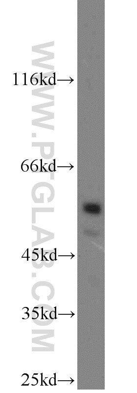 Western Blot (WB) analysis of RAW264.7 using USP3 Polyclonal antibody (12490-1-AP)