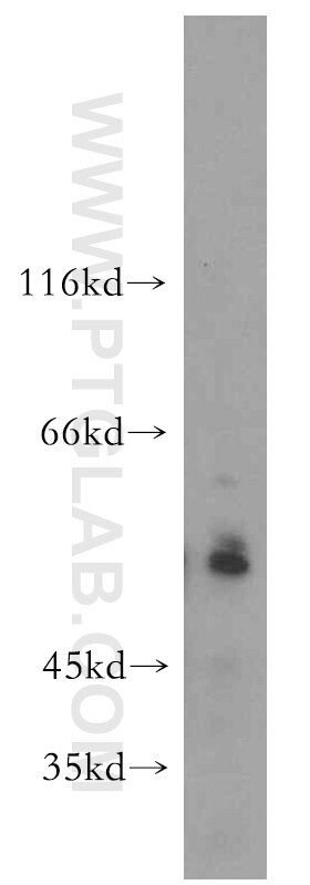 Western Blot (WB) analysis of K-562 cells using USP3 Polyclonal antibody (12490-1-AP)