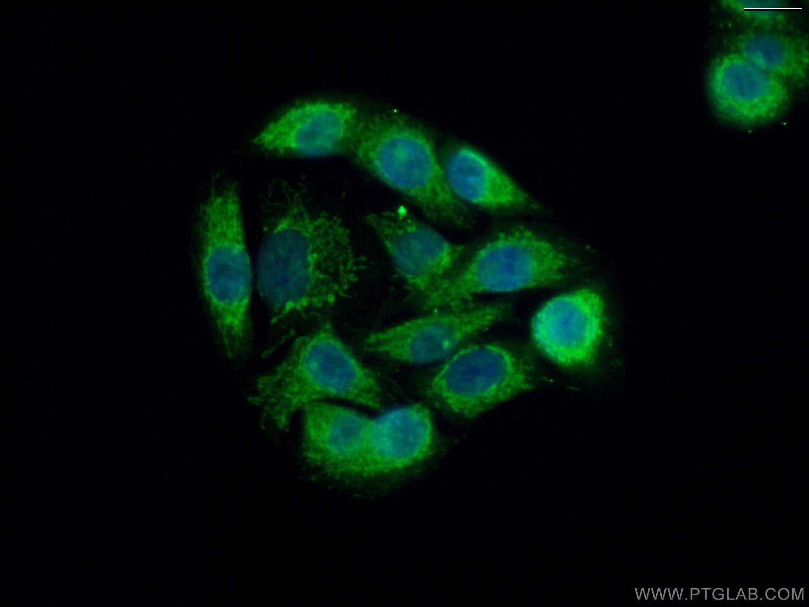 Immunofluorescence (IF) / fluorescent staining of A549 cells using USP30 Polyclonal antibody (15402-1-AP)