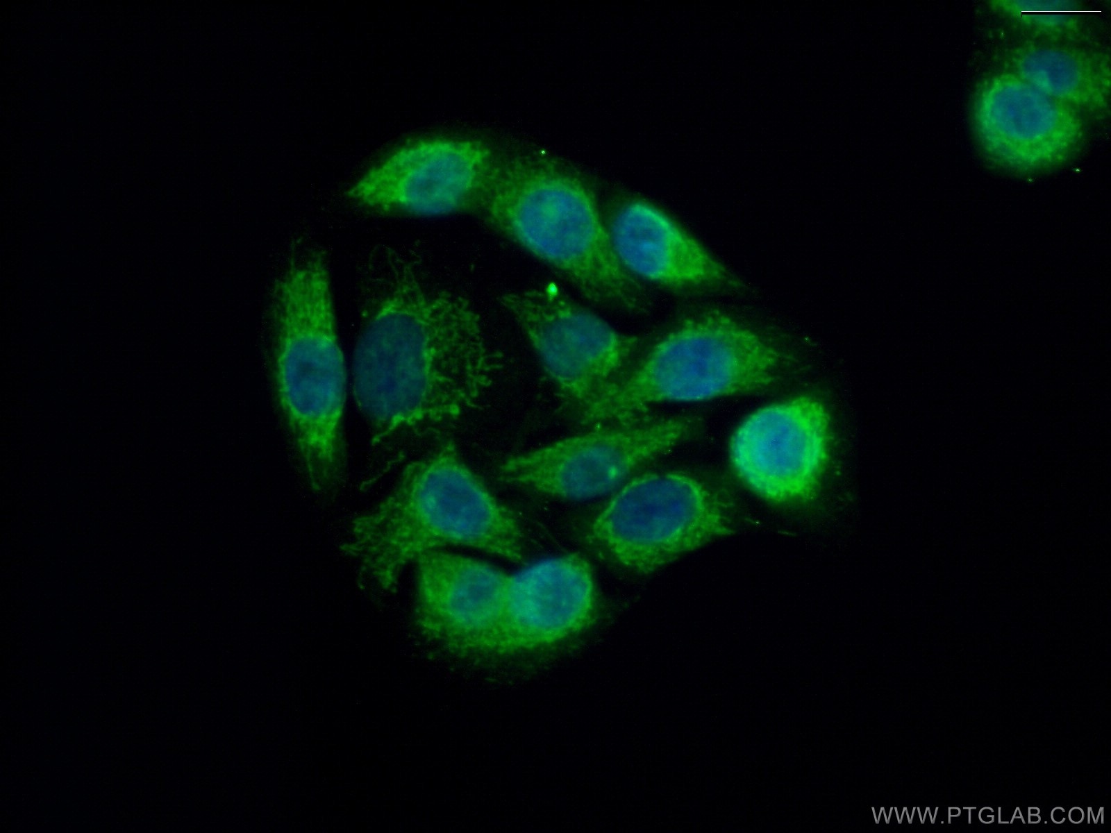 IF Staining of A549 using 15402-1-AP