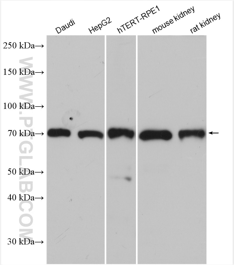 Western Blot (WB) analysis of various lysates using USP30 Polyclonal antibody (15402-1-AP)