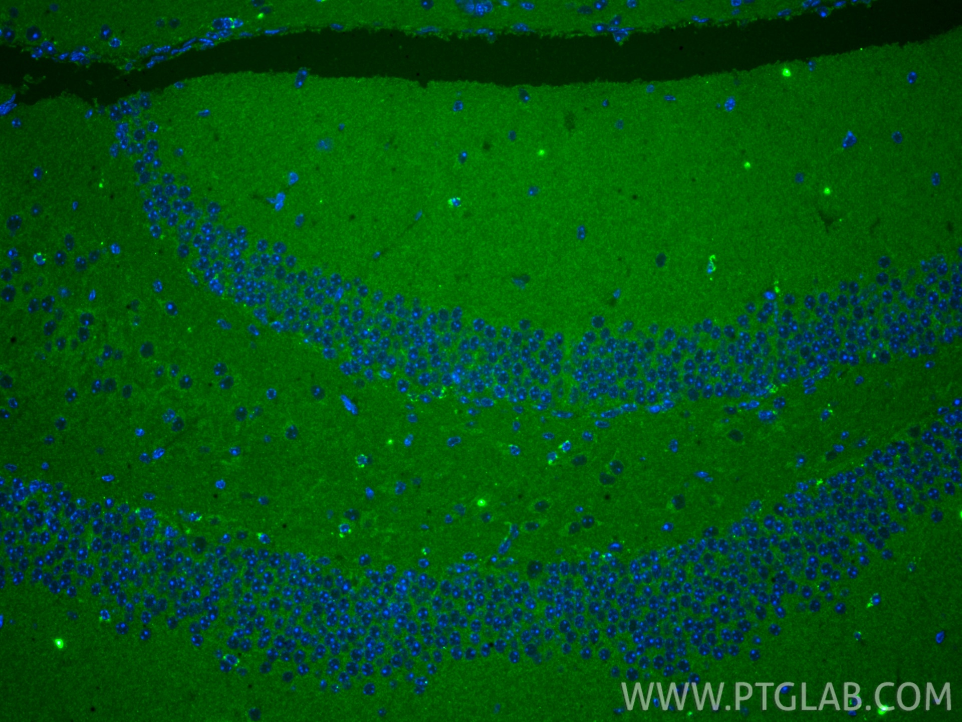 IF Staining of mouse brain using 83240-5-RR Immunofluorescence (IF) / fluorescent staining of mouse brain tissue using USP30 Recombinant monoclonal antibody (83240-5-RR)