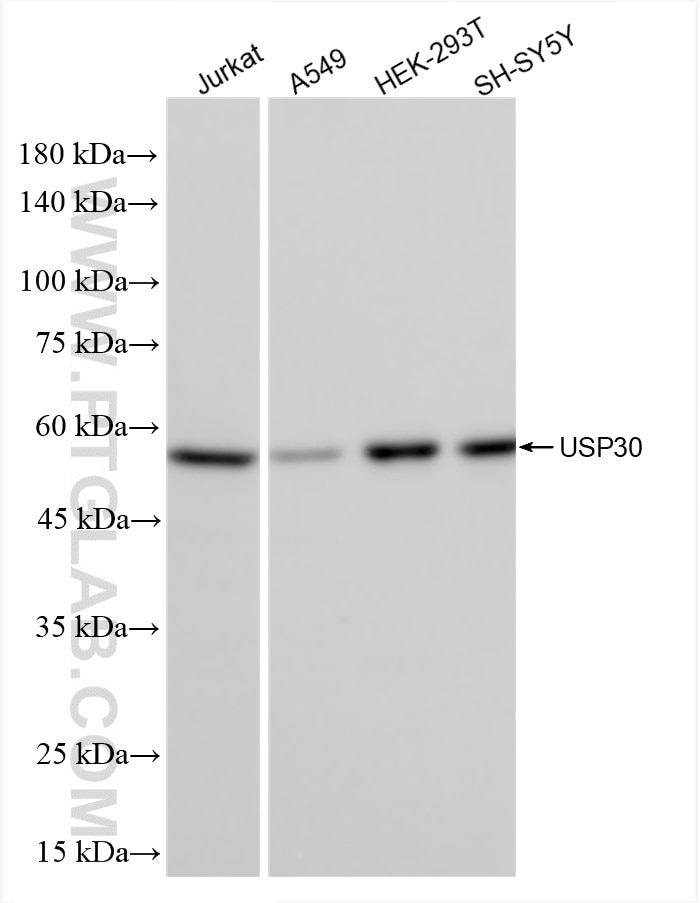 Western Blot (WB) analysis of various lysates using USP30 Recombinant antibody (83240-5-RR)
