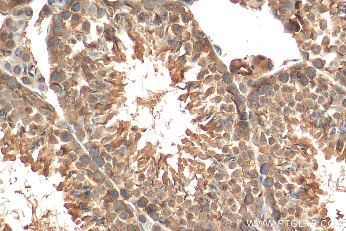 Immunohistochemistry (IHC) staining of mouse testis tissue using USP32 Polyclonal antibody (18838-1-AP)