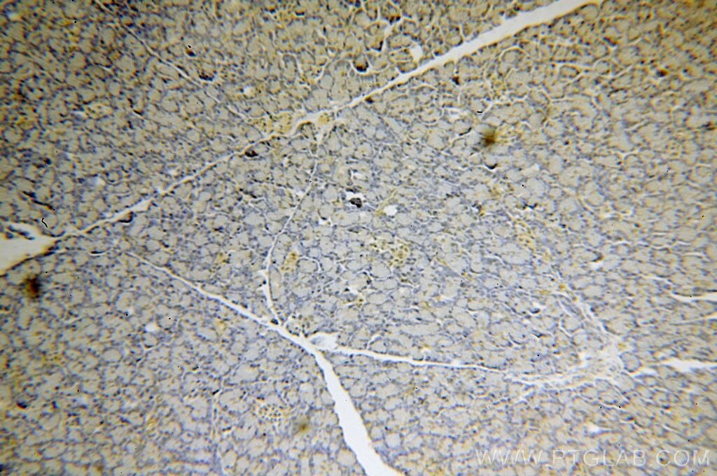 Immunohistochemistry (IHC) staining of human pancreas tissue using USP32 Polyclonal antibody (18838-1-AP)