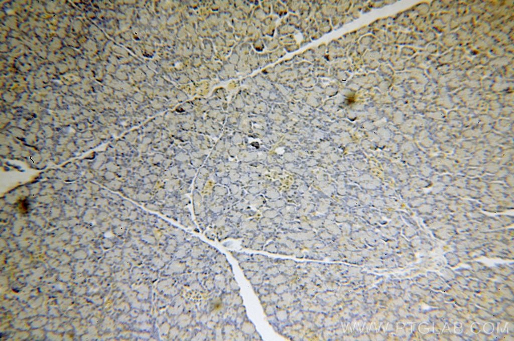 IHC staining of human pancreas using 18838-1-AP