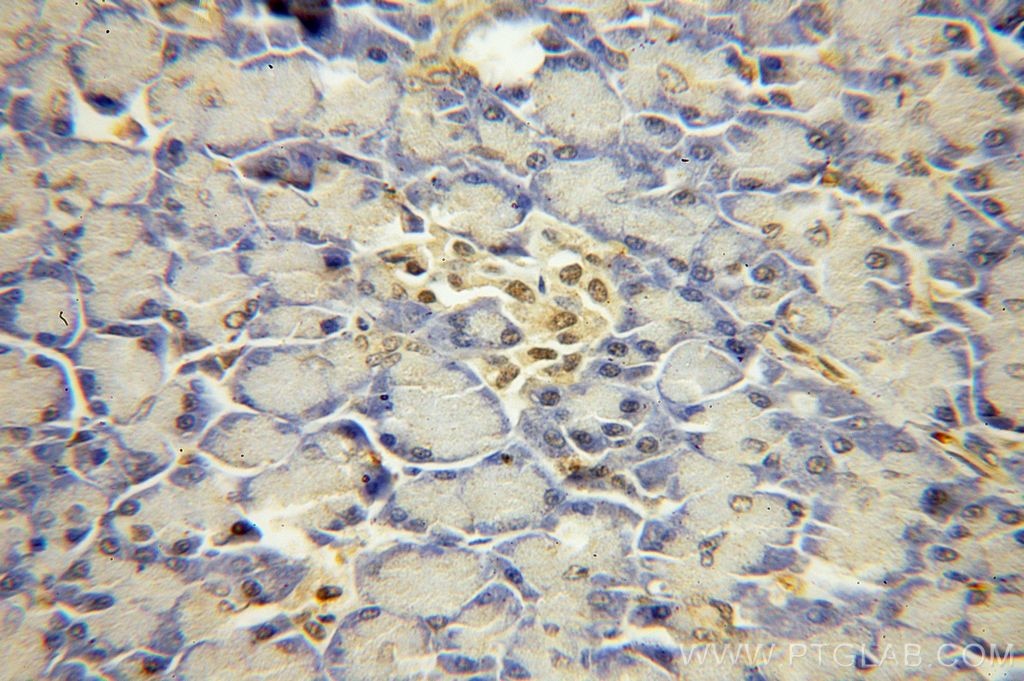 Immunohistochemistry (IHC) staining of human pancreas tissue using USP32 Polyclonal antibody (18838-1-AP)