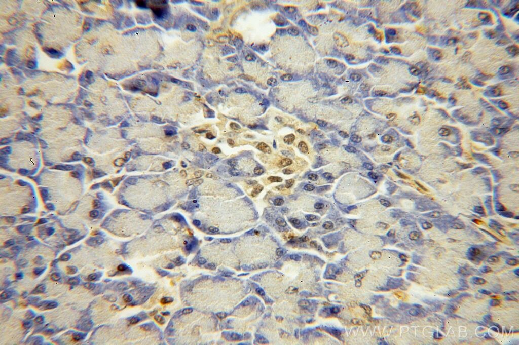 Immunohistochemistry (IHC) staining of human pancreas tissue using USP32 Polyclonal antibody (18838-1-AP)