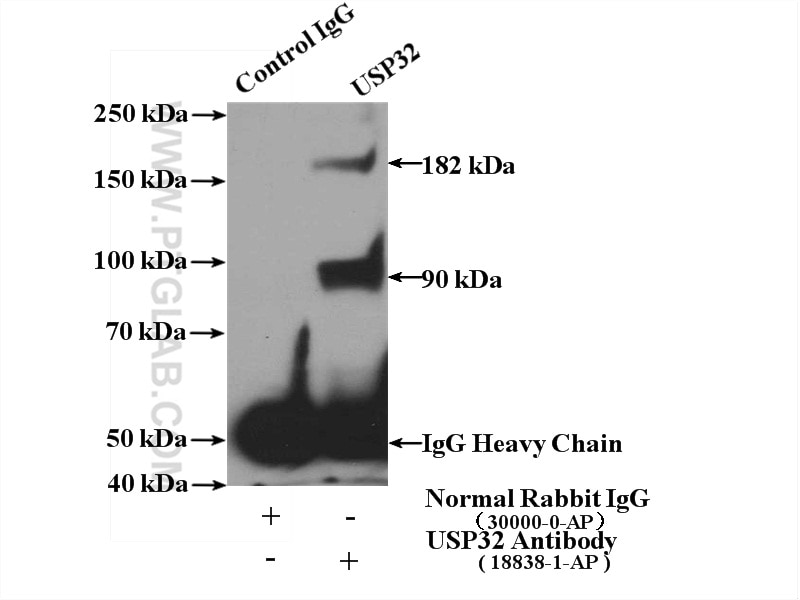 Immunoprecipitation (IP) experiment of HeLa cells using USP32 Polyclonal antibody (18838-1-AP)