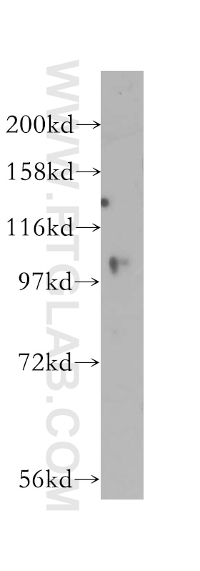 Western Blot (WB) analysis of HEK-293 cells using USP33 Polyclonal antibody (12060-2-AP)