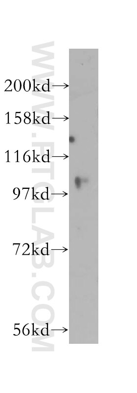 WB analysis of HEK-293 using 12060-2-AP