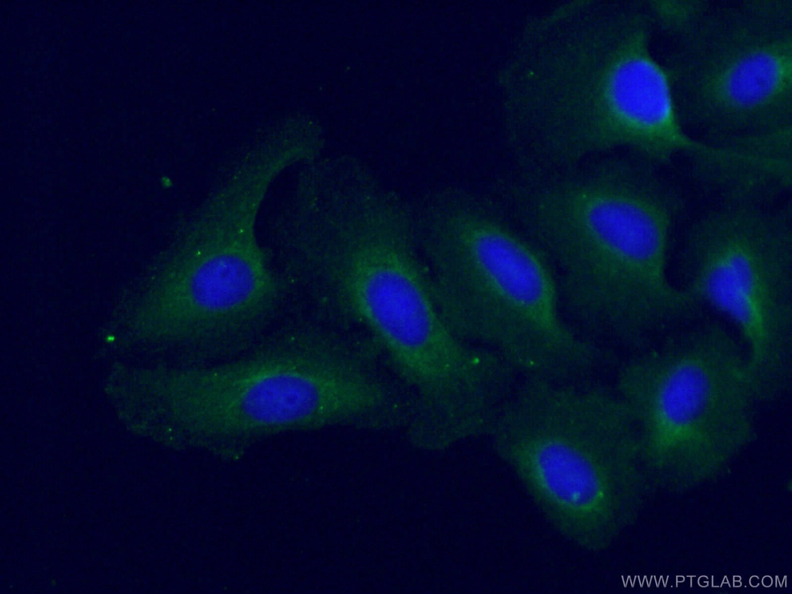 Immunofluorescence (IF) / fluorescent staining of U2OS cells using USP33 Polyclonal antibody (20445-1-AP)