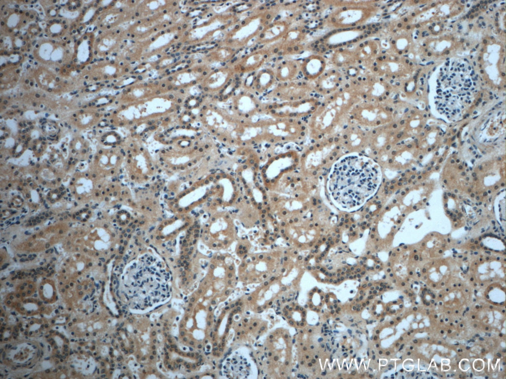 Immunohistochemistry (IHC) staining of human kidney tissue using USP33 Polyclonal antibody (20445-1-AP)