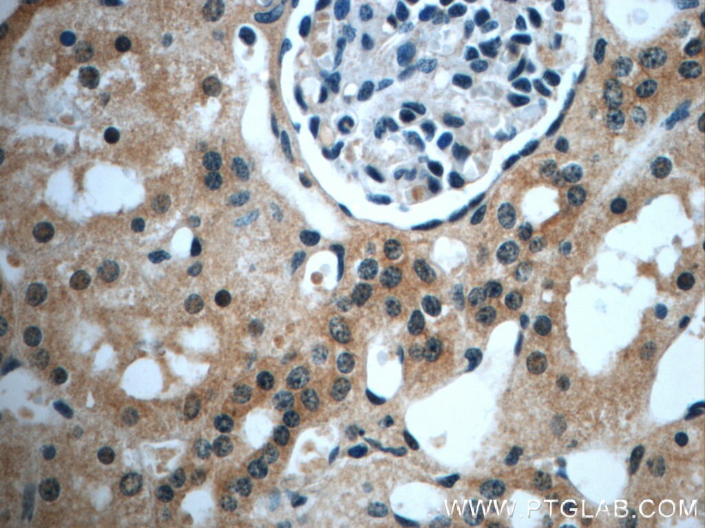 Immunohistochemistry (IHC) staining of human kidney tissue using USP33 Polyclonal antibody (20445-1-AP)