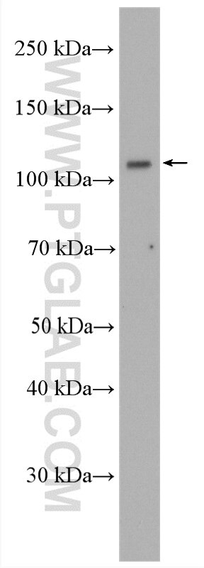 Western Blot (WB) analysis of mouse brain tissue using USP33 Polyclonal antibody (20445-1-AP)